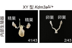 妊娠中の“鉄不足”が子どもの性決定に影響する可能性 - 阪大の研究